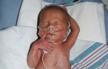 Heart of Minky: Kohen, a NICU baby resting peacefully with medical equipment.