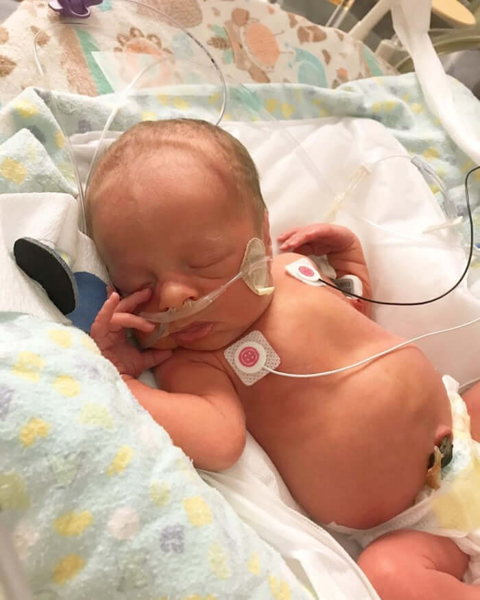 Heart of Minky: Nixon, a sweet baby boy peacefully resting in a hospital setting, connected to medical equipment.