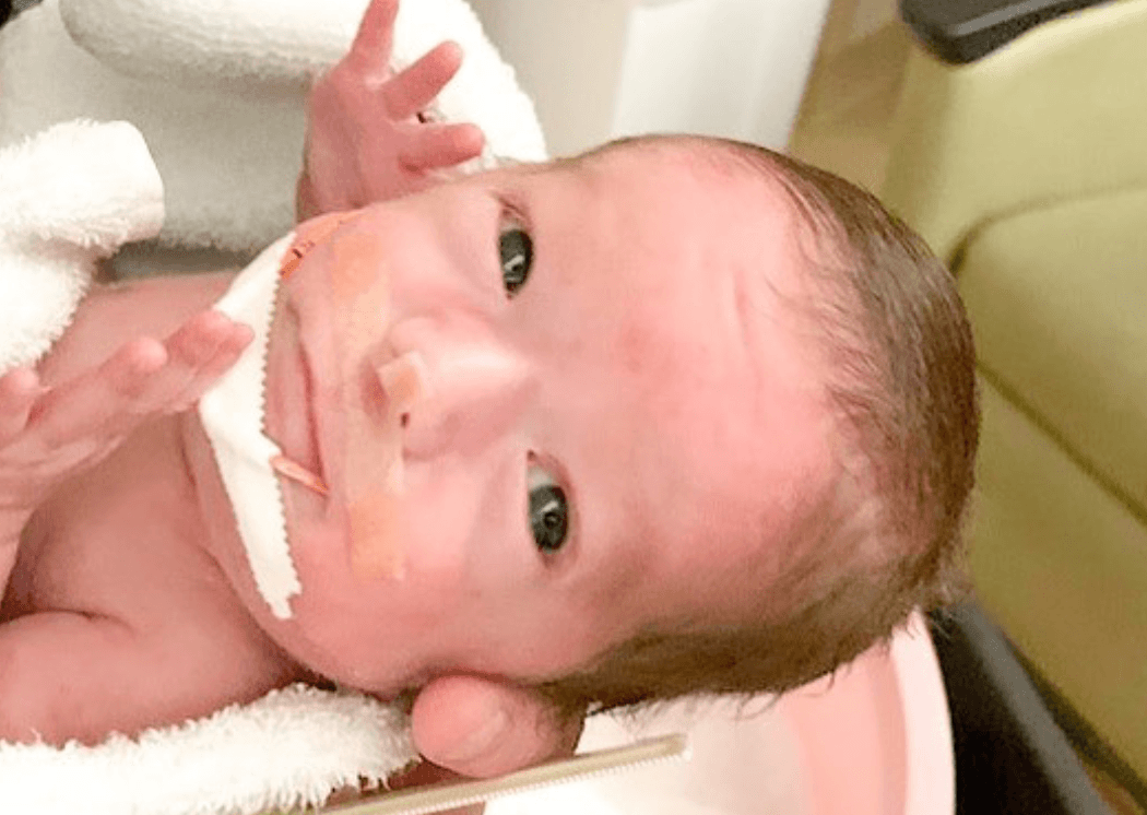 Heart of Minky: Felix, a baby receiving care, with a breathing tube and wrapped in a towel.